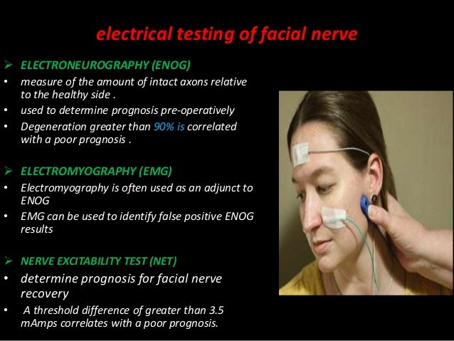 testing facial nerve Testing facial nerve